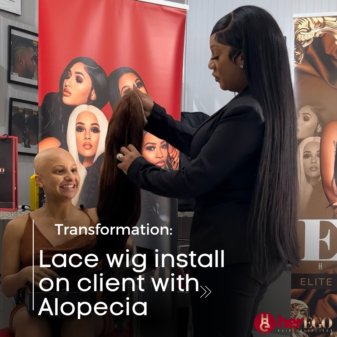 Lace wig install on Alopecia Client